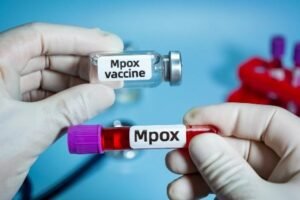 Mpox: RD Congo inicia vacinação contra vírus com 265 mil doses