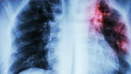 OMS pré-qualifica primeiro teste de diagnóstico da...