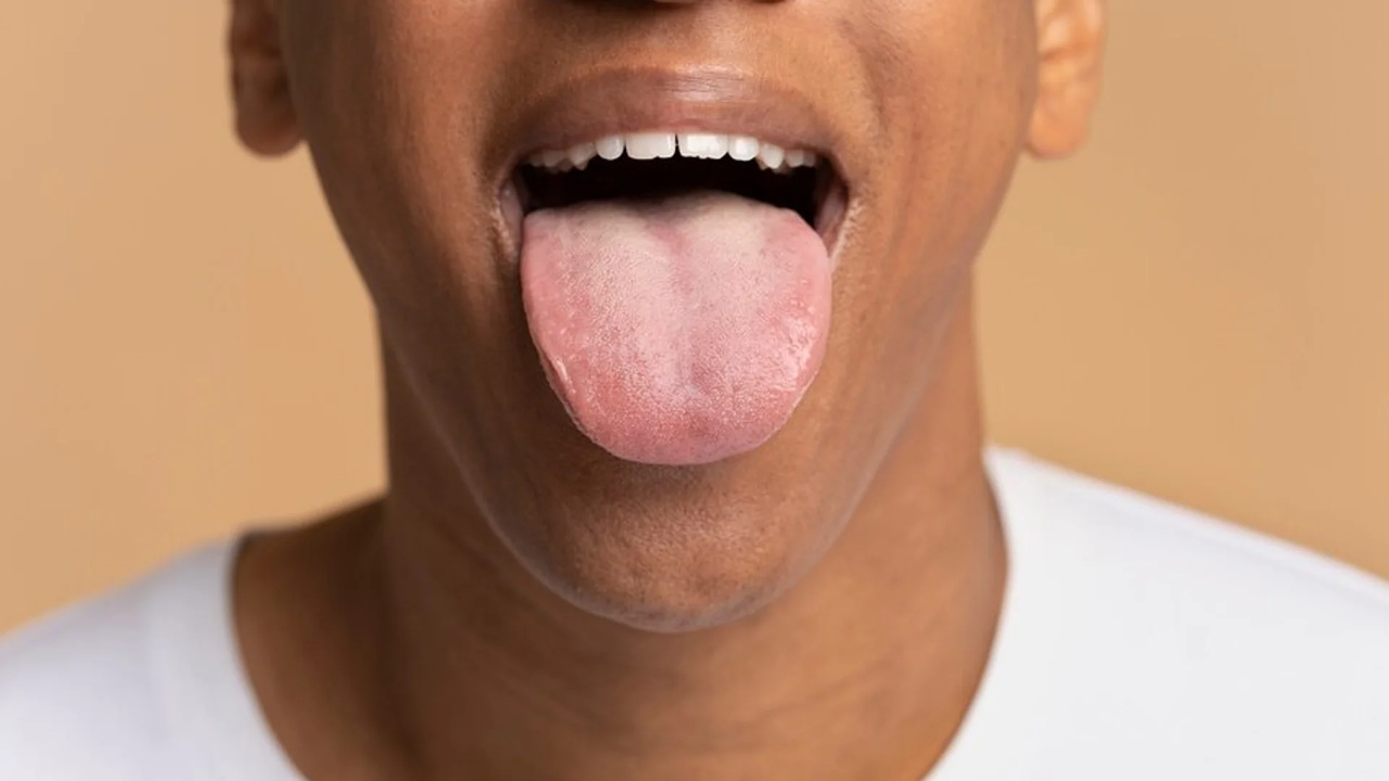 IA Consegue Identificar Doenças Com Base na Cor da Língua •...