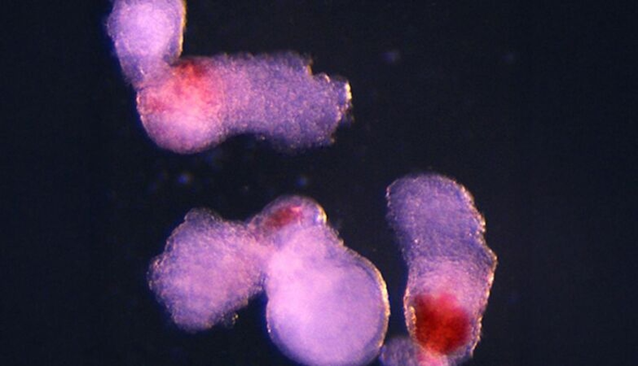 Cientistas Criam “Embrião” Que Produz Sangue Para...